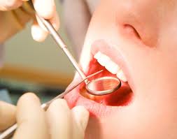 De Ce Sa Mergi la Dentist?