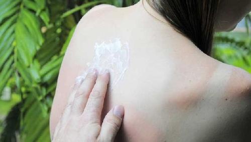 Cum sa eviti arsurile solare si petele