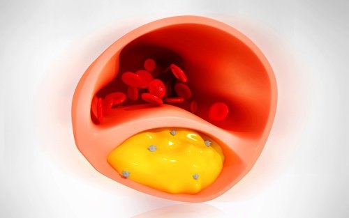 5 alimente care iti pot curata arterele