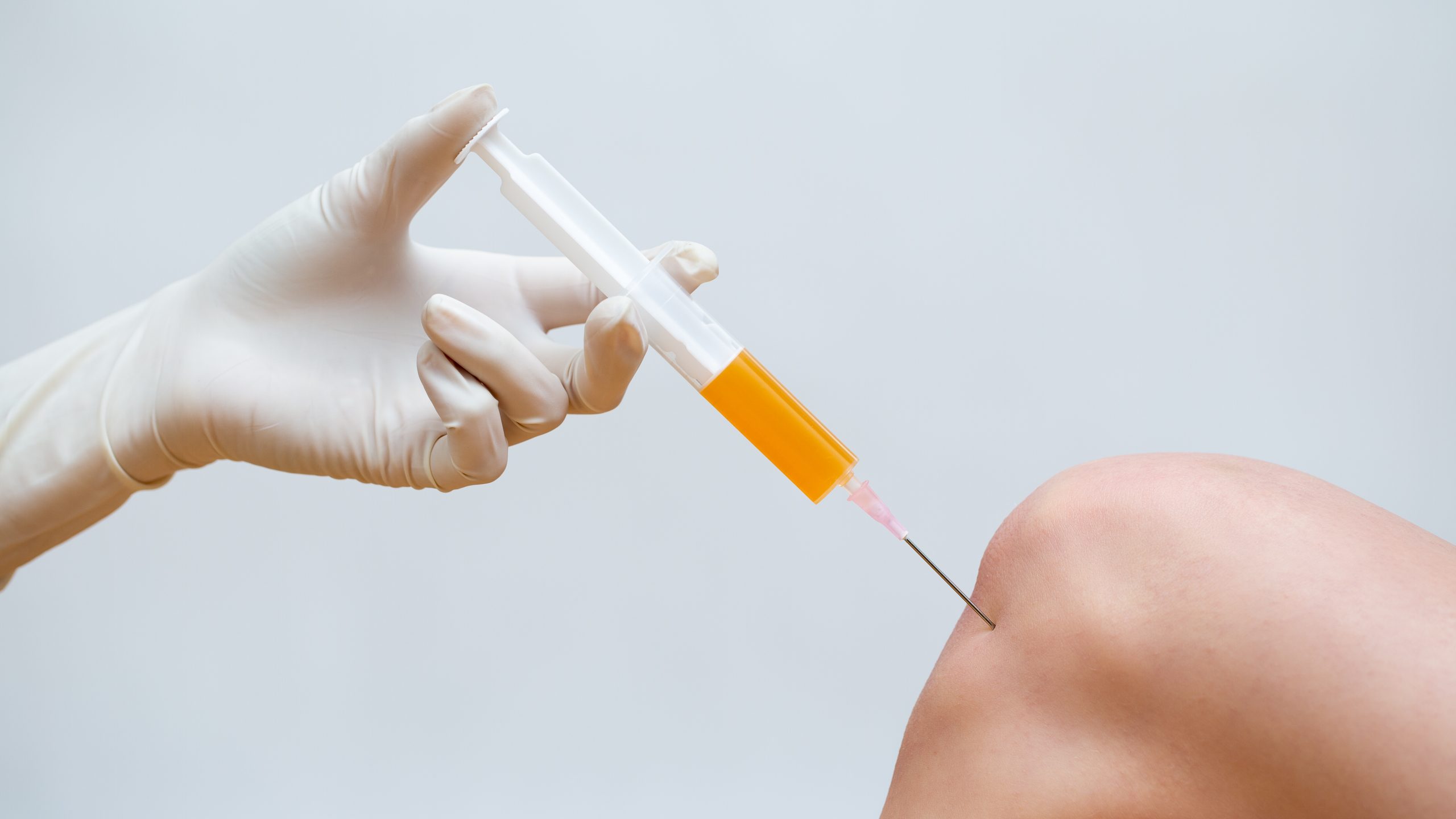De ce e benefic tratamentul PRP cu acid hialuronic?