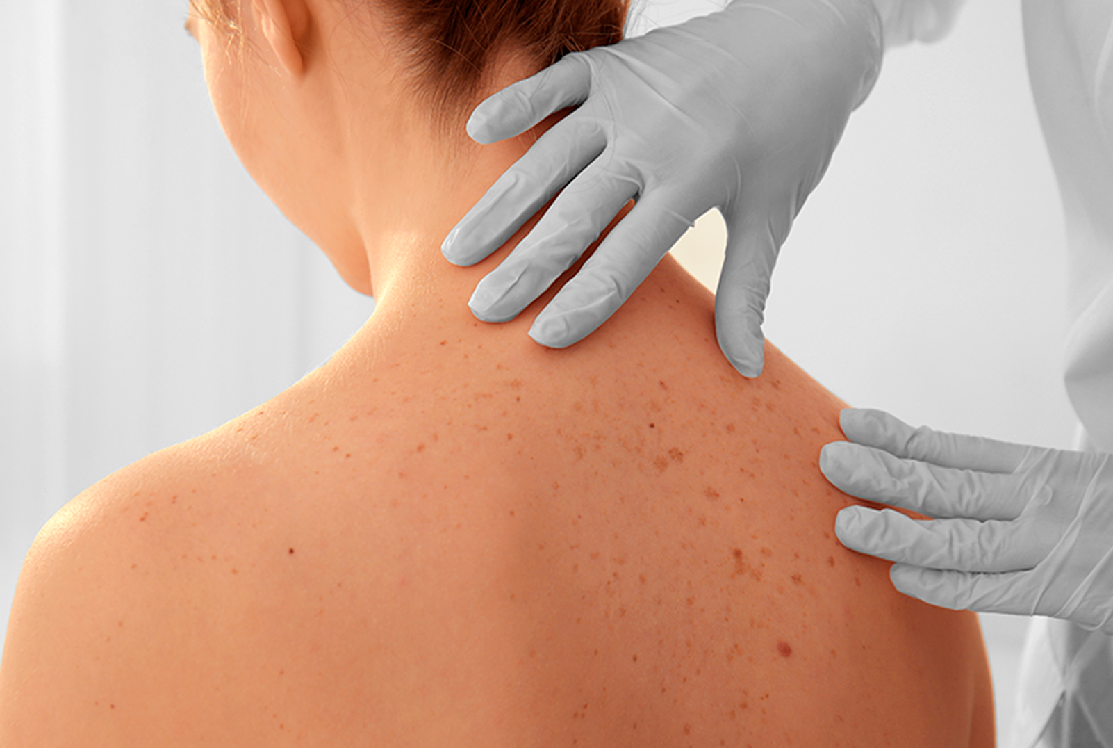 De ce ar trebui să vizitați o clinică de dermatologie: Beneficiile unei consultații specializate