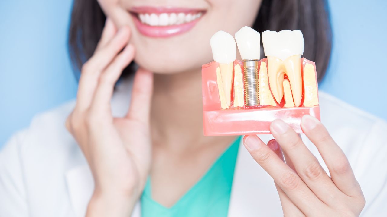 Implantul dentar – Ce este și cum a evoluat?
